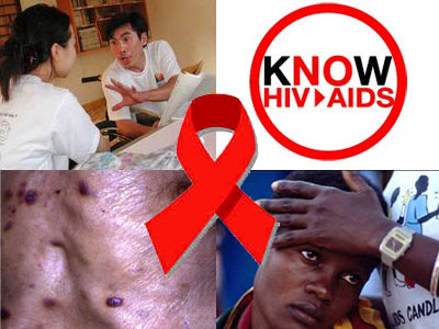 HIV / AIDS: Isu Siguransa  Publiku Nian post thumbnail image